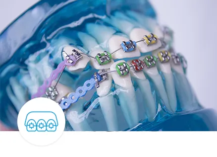 stomis-orthodontics-ortodontie